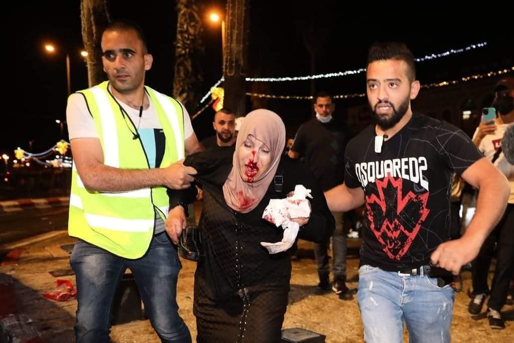 المقدسية زينب سليمان.. نزيفُ دمها أصاب قلوبَ الفلسطينيين بالحسرة