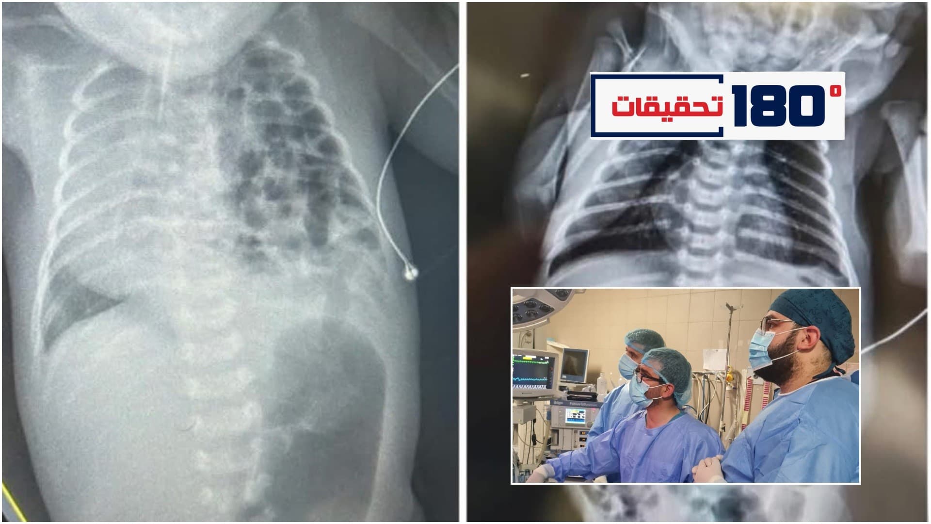 عملية مستشفى الخليل الحكومي