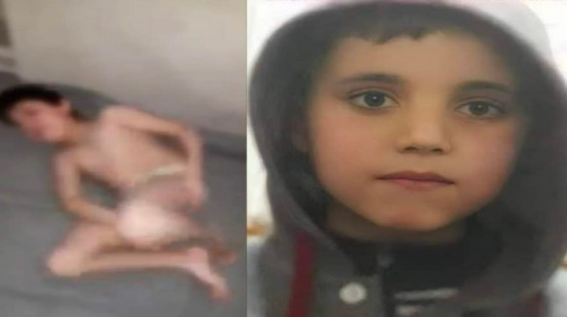 حملة تضامن واسعة مع الطفل السوري فواز قطيفان لإنقاذه..فما قصته؟