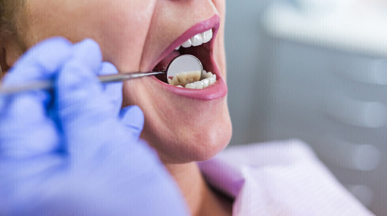 سوء صحة الأسنان قد يعرضك لخطر تلف الرئة