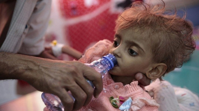 سعي أممي لجمع 4.3 مليار دولار تجنبا لمجاعة في اليمن