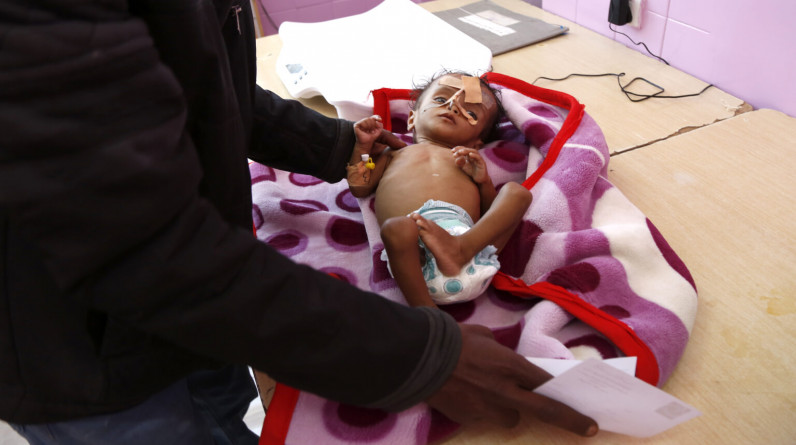 الأمم المتحدة تحذر من أزمة جوع كارثية في اليمن